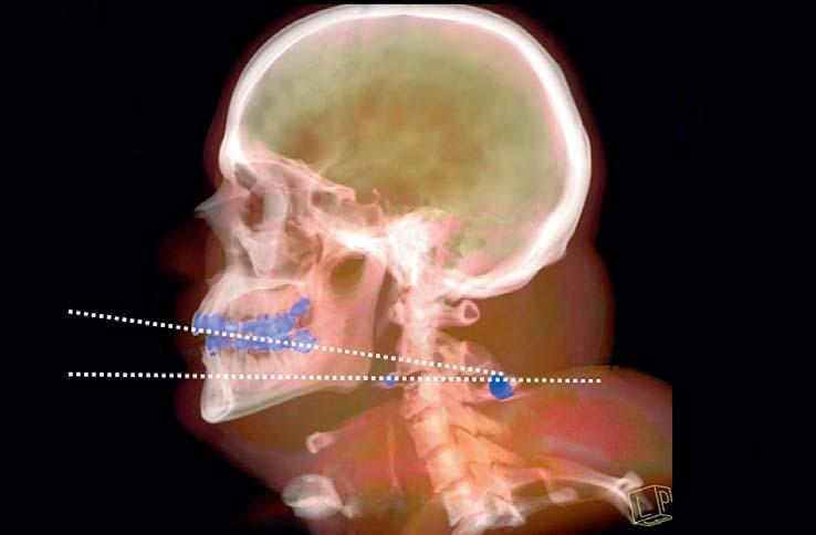 Autopsia virtual